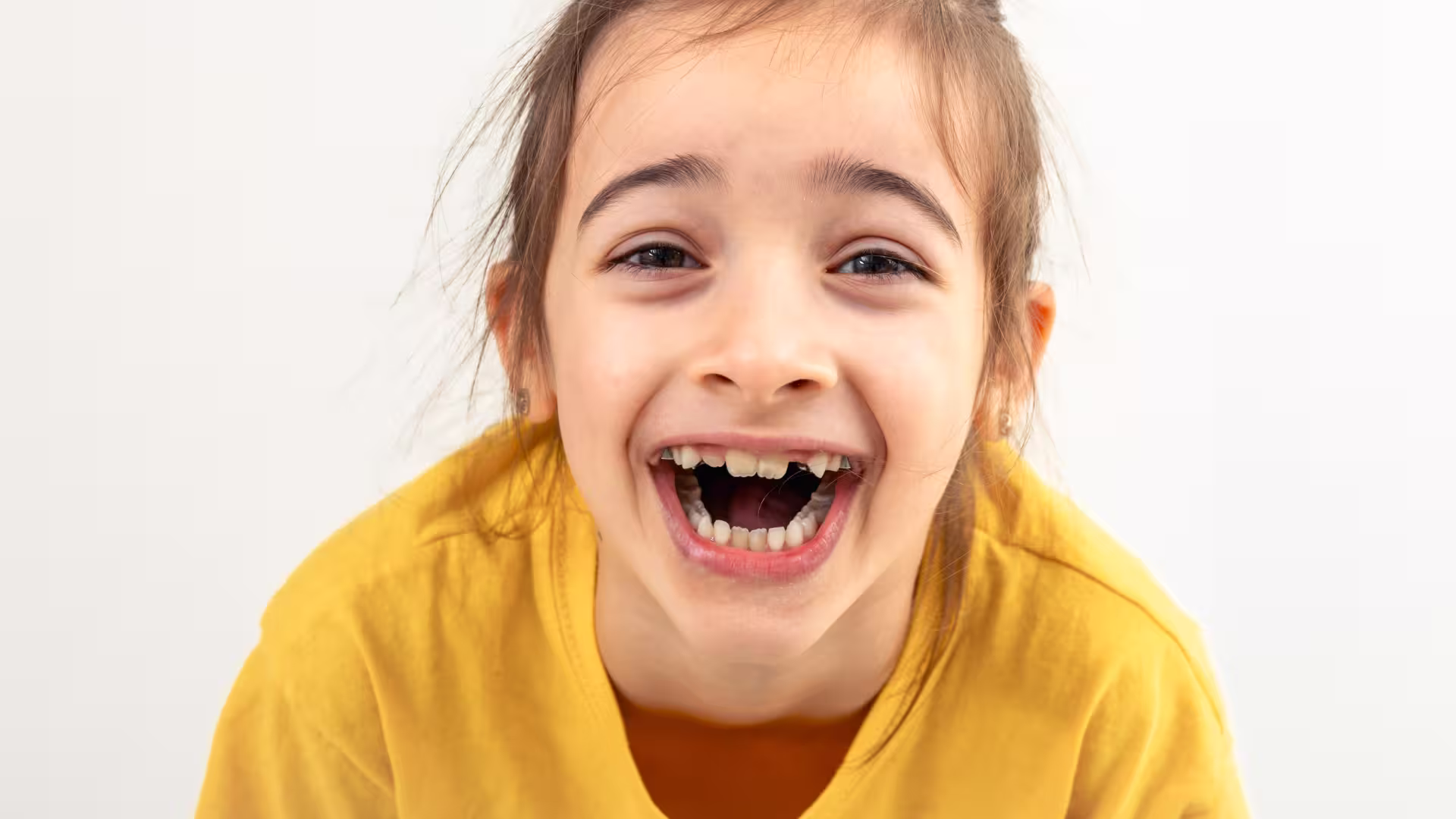 Maloklüzyon Nedir? Belirtileri ve Türleri